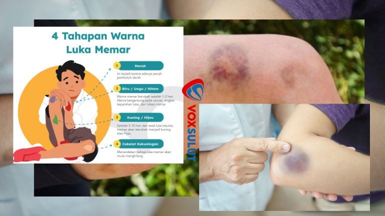 Waspadai 11 Penyakit Syaraf Berikut Ini, Kenali Gejala Awalnya!