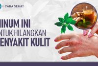 Cara Mengenali dan Mengatasi Penyakit Kulit Bernanah pada Anak