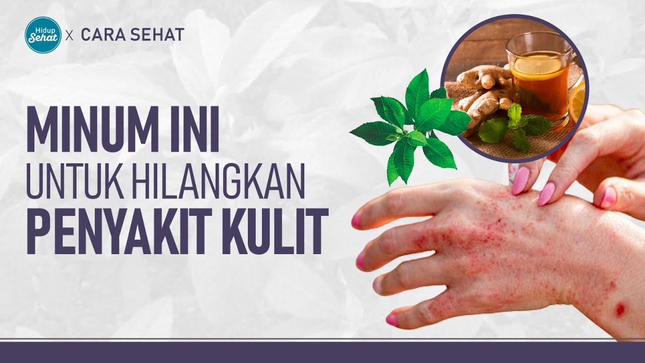 Cara Mengenali dan Mengatasi Penyakit Kulit Bernanah pada Anak